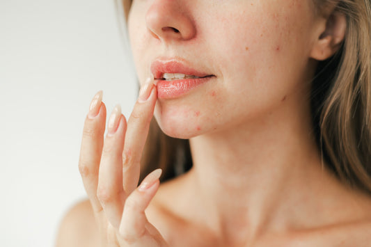 How to treat 5 common skin concerns